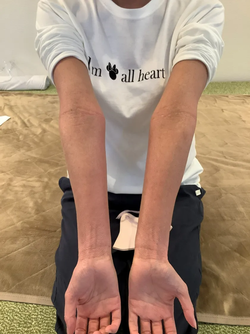 症例2 施術後