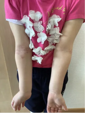 症例3 施術前