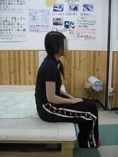 猫背 施術前
